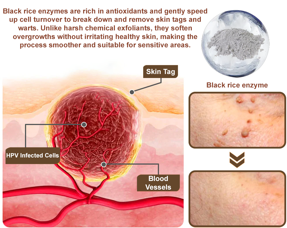 Zvoevo® Black Rice Skin Repair Essence Cream ⚕️ FDA Certified (Removes warts and skin growths, improves keratin buildup and seborrheic dermatitis, follicular keratosis, age spots, and bruising)