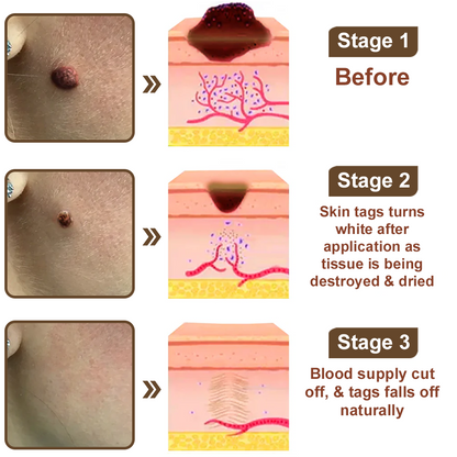 Zvoevo® Black Rice Skin Repair Essence Cream ⚕️ FDA Certified (Removes warts and skin growths, improves keratin buildup and seborrheic dermatitis, follicular keratosis, age spots, and bruising)