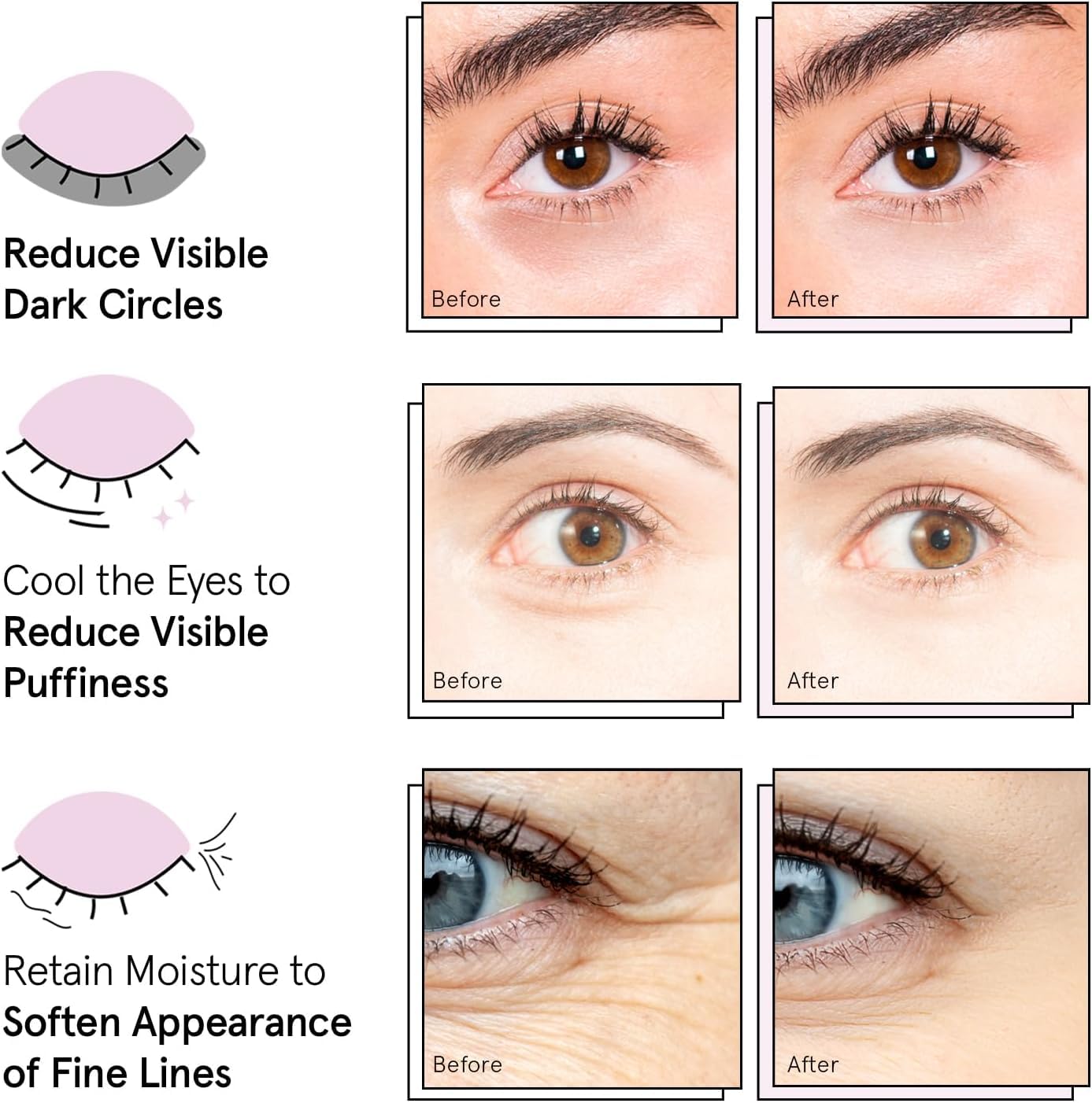 Grace & Stella Under Eye Mask - Reduce Dark Circles, Puffy Eyes, Undereye Bags & Wrinkles - Gel Under Eye Patches, Vegan & Cruelty-Free Self Care (72 Pairs, Gold Pink Blue)