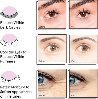 Grace & Stella Under Eye Mask - Reduce Dark Circles, Puffy Eyes, Undereye Bags & Wrinkles - Gel Under Eye Patches, Vegan & Cruelty-Free Self Care (72 Pairs, Gold Pink Blue)