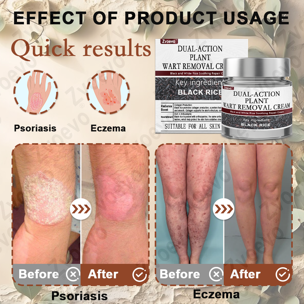 Zvoevo® Black Rice Skin Repair Essence Cream ⚕️ FDA Certified (Removes warts and skin growths, improves keratin buildup and seborrheic dermatitis, follicular keratosis, age spots, and bruising)